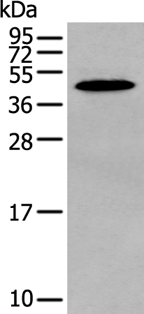 Anti-MAGEB18 Rabbit Polyclonal Antibody