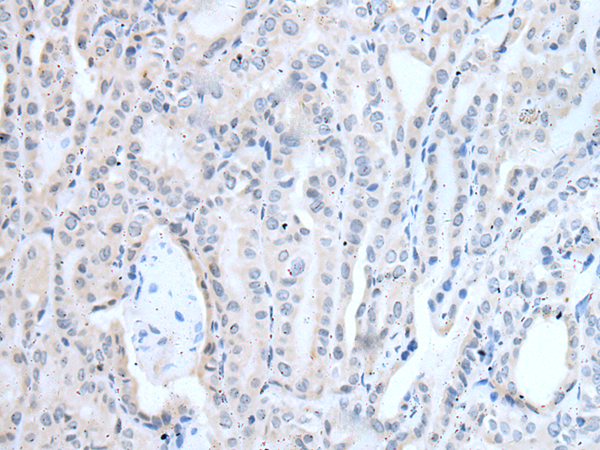 Anti-LAT Rabbit Polyclonal Antibody