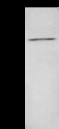 Anti-ADCY2 Rabbit Polyclonal Antibody