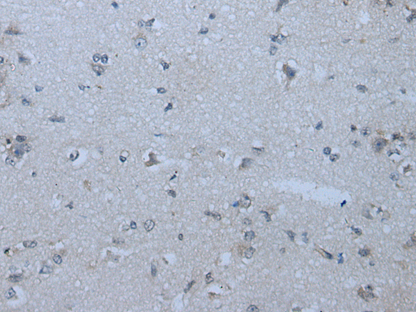 Anti-ApoL4 Rabbit Polyclonal Antibody