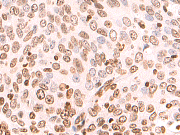 Anti-HAND1 Rabbit Polyclonal Antibody