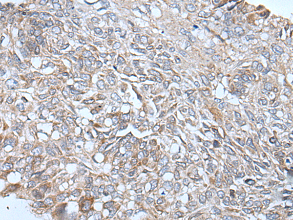 Anti-ETFB Rabbit Polyclonal Antibody