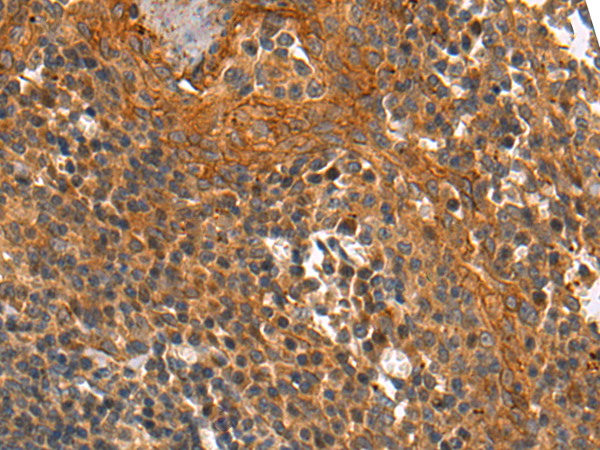 Anti-Kallikrein 12 Rabbit Polyclonal Antibody