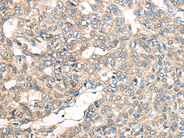 Anti-LRP1B Rabbit Polyclonal Antibody