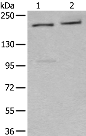 Anti-XRN1 Rabbit Polyclonal Antibody