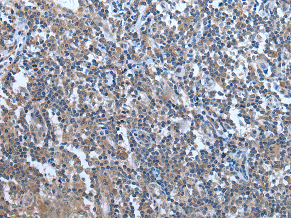 Anti-WDR11 Rabbit Polyclonal Antibody