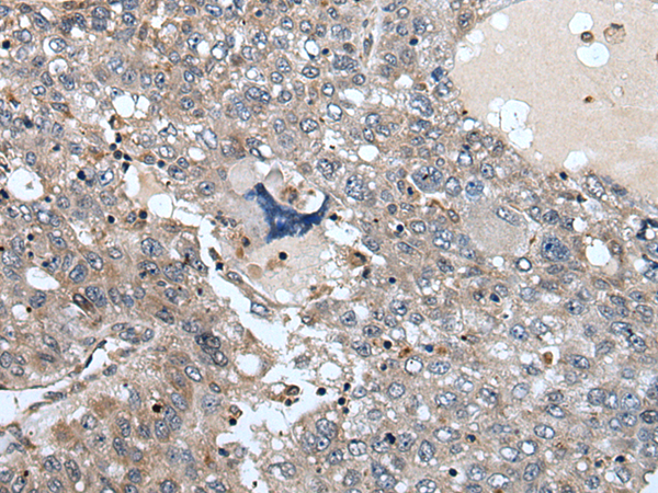Anti-WDSUB1 Rabbit Polyclonal Antibody