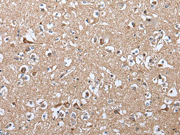 Anti-WIPI2 Rabbit Polyclonal Antibody