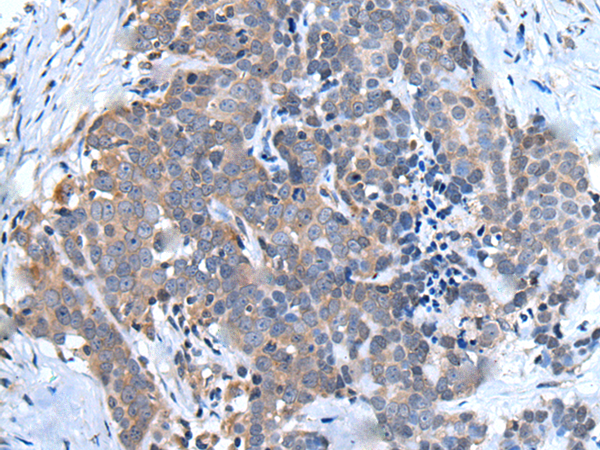 Anti-Ubiquilin 2 Rabbit Polyclonal Antibody
