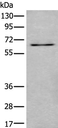 Anti-Ubiquilin 2 Rabbit Polyclonal Antibody