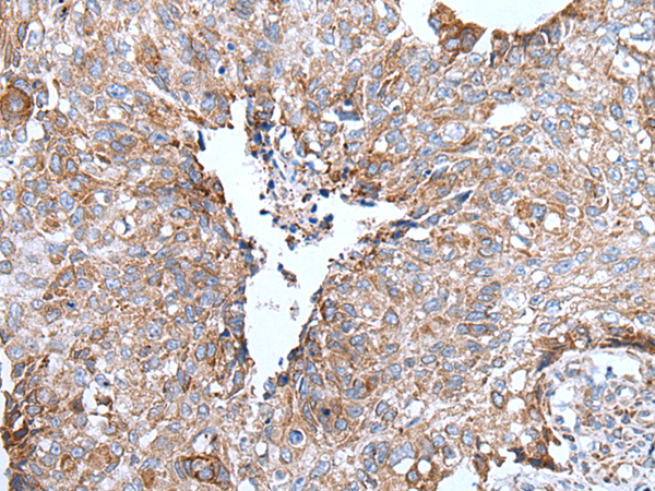 Anti-UGGT1 Rabbit Polyclonal Antibody
