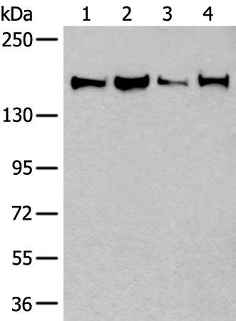 Anti-UGGT1 Rabbit Polyclonal Antibody