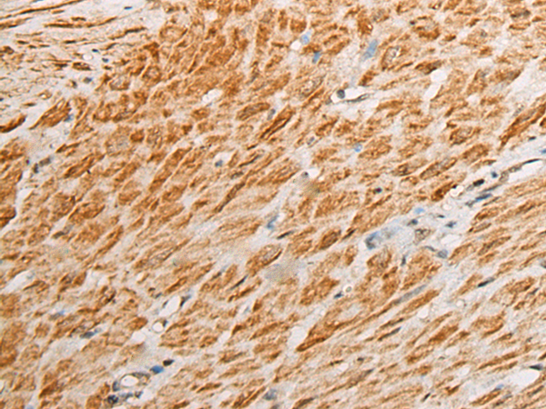 Anti-UTP18 Rabbit Polyclonal Antibody