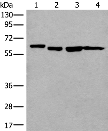 Anti-UTP18 Rabbit Polyclonal Antibody