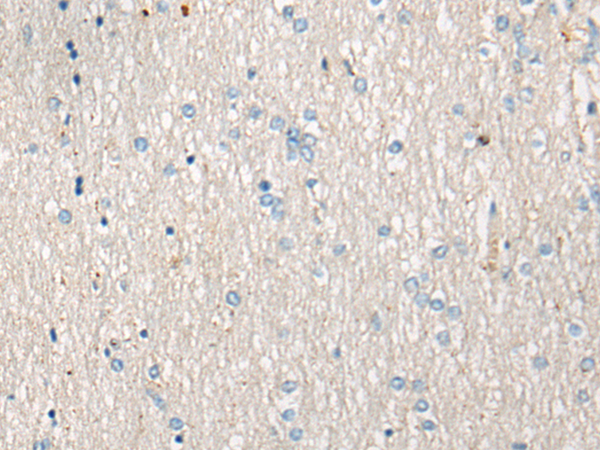 Anti-AVPR1B Rabbit Polyclonal Antibody