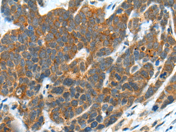 Anti-B3GNT3 Rabbit Polyclonal Antibody