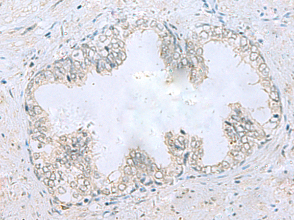 Anti-beta IIA Tubulin Rabbit Polyclonal Antibody