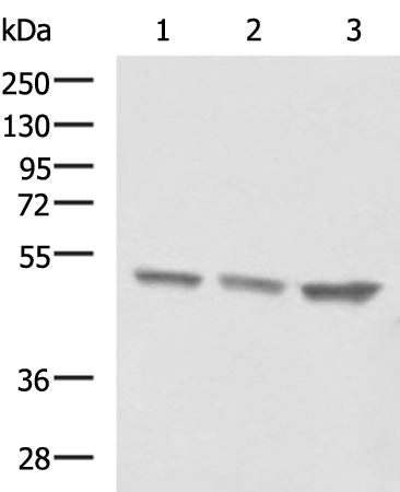 Anti-beta IIA Tubulin Rabbit Polyclonal Antibody