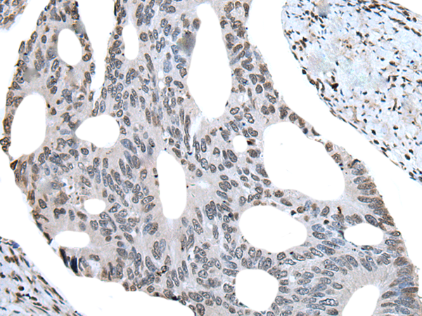 Anti-MIST 1 Rabbit Polyclonal Antibody