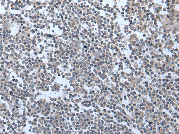 Anti-BMP1 Rabbit Polyclonal Antibody