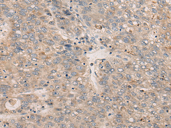 Anti-BMP10 Rabbit Polyclonal Antibody