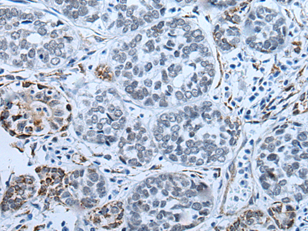 Anti-BTB/POZ Domain Containing Protein 6 Rabbit Polyclonal Antibody