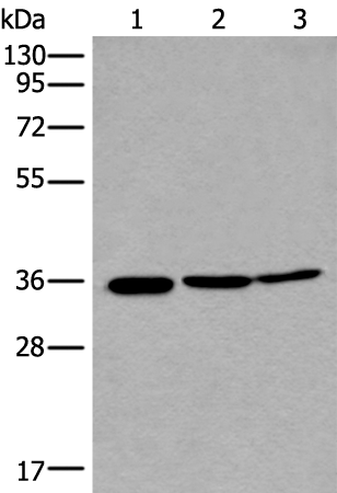 Anti-RPF2 Rabbit Polyclonal Antibody