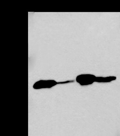 Anti-Transmembrane Protein 254 Rabbit Polyclonal Antibody