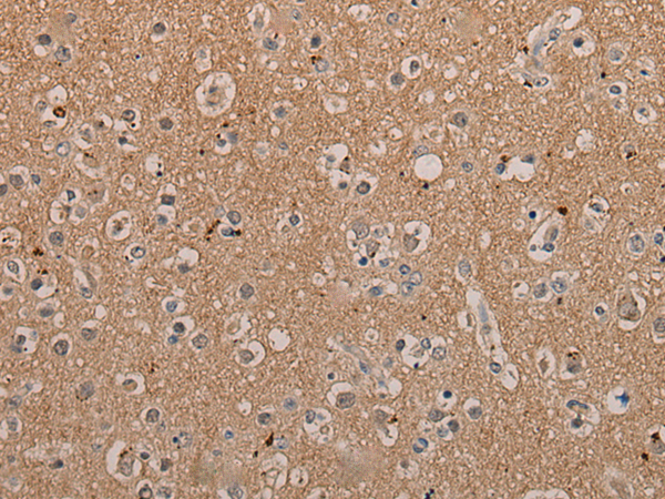 Anti-FAM234A Rabbit Polyclonal Antibody