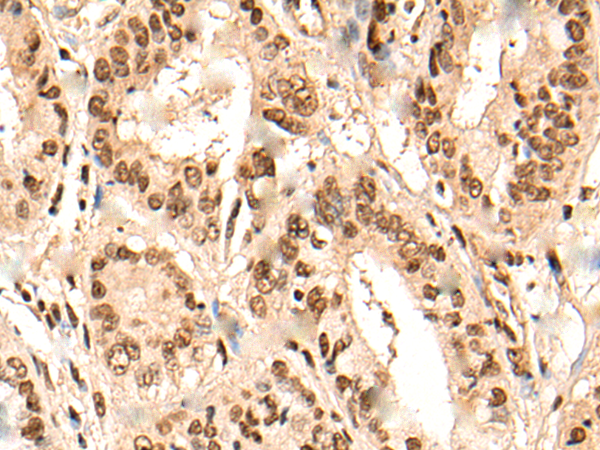 Anti-URI1 Rabbit Polyclonal Antibody