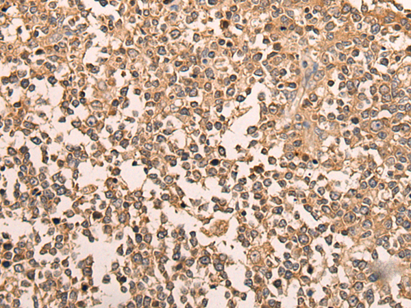 Anti-LDAH Rabbit Polyclonal Antibody