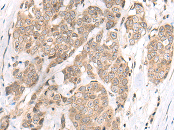 Anti-M1AP Rabbit Polyclonal Antibody
