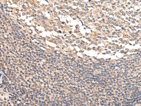 Anti-Calcyphosine Rabbit Polyclonal Antibody