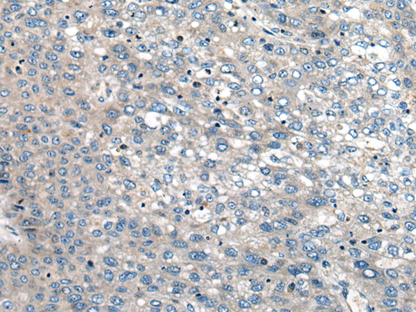 Anti-CEBPZ Rabbit Polyclonal Antibody
