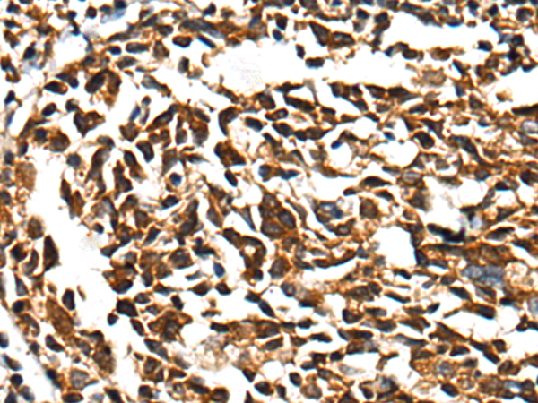 Anti-CD101 Rabbit Polyclonal Antibody