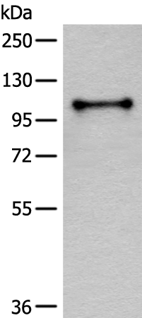 Anti-CD101 Rabbit Polyclonal Antibody