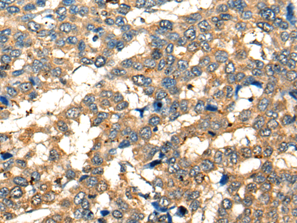 Anti-CD28 Rabbit Polyclonal Antibody