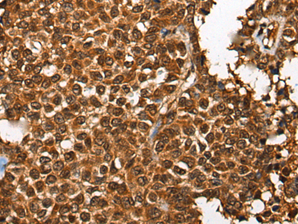 Anti-CDKL4 Rabbit Polyclonal Antibody