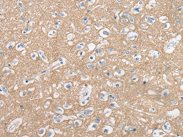 Anti-Cell Adhesion Molecule 2 Rabbit Polyclonal Antibody