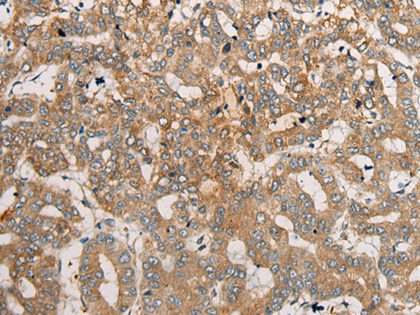 Anti-CEND1 Rabbit Polyclonal Antibody