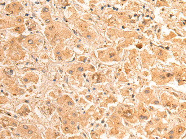 Anti-HAUS2 Rabbit Polyclonal Antibody