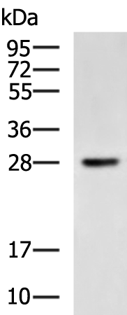 Anti-HAUS2 Rabbit Polyclonal Antibody