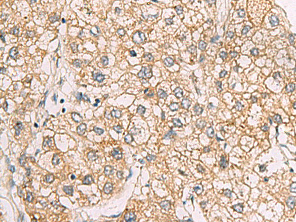 Anti-CHST2 Rabbit Polyclonal Antibody