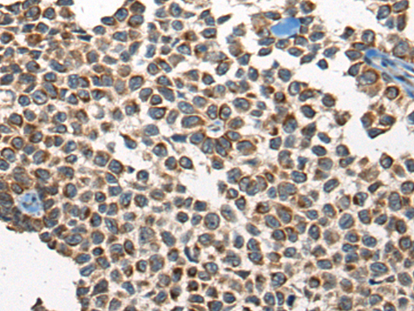 Anti-COP Rabbit Polyclonal Antibody