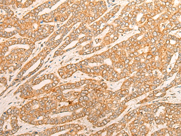 Anti-RANKL Rabbit Polyclonal Antibody