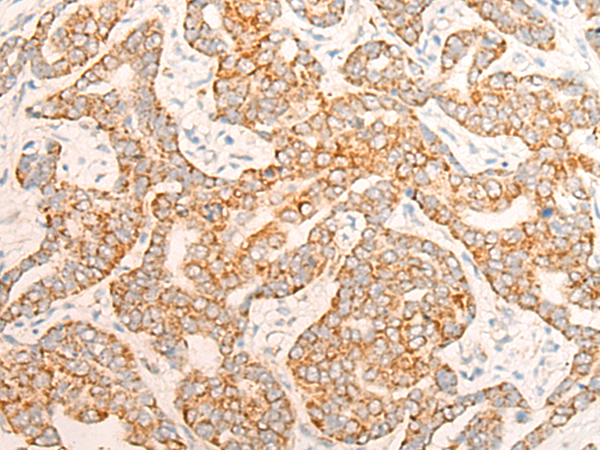 Anti-ALDH7A1 Rabbit Polyclonal Antibody