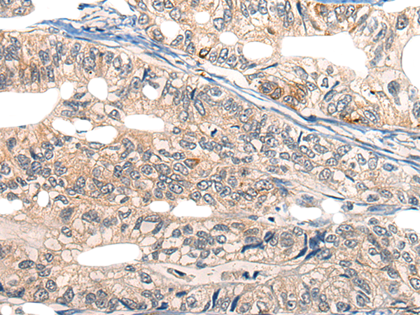 Anti-Ephrin Receptor A6 Rabbit Polyclonal Antibody