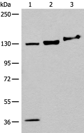 Anti-Ephrin Receptor A6 Rabbit Polyclonal Antibody