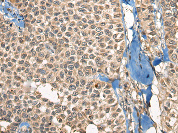 Anti-CHFR Rabbit Polyclonal Antibody