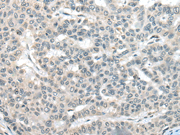 Anti-Urocortin 3 Rabbit Polyclonal Antibody